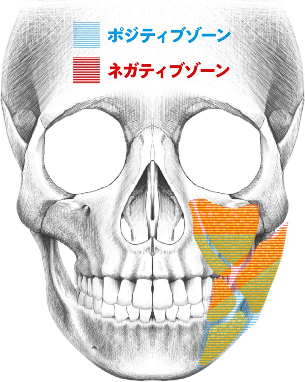 ポジティブゾーンとネガティブゾーンの部位の色分け図