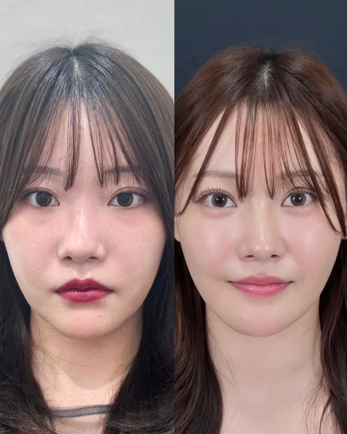 Before/After