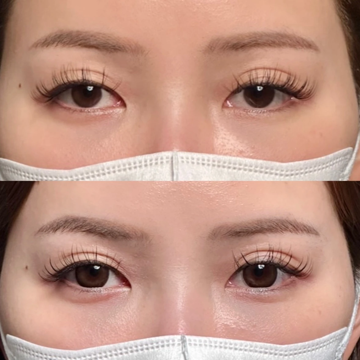 Before/After