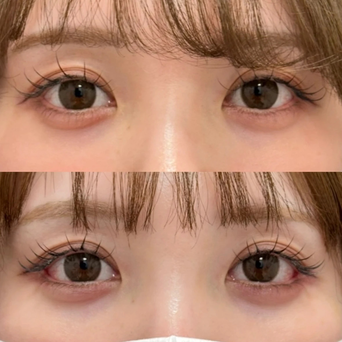 Before/After